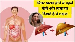 चेहरे पर दिखने लगे ये 5 लक्षण तो खतरे में है लिवर, एक्सपर्ट से जानिए कैसे करें बचाव