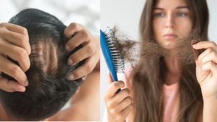 hair fall control |Sudden hair fall reasons | hair loss