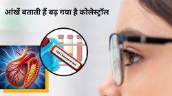 Warning Sign of Bad Cholesterol: कोलेस्ट्रॉल बढ़ने पर आंखो में दिखते हैं यह 5 लक्षण, तुरंत करें इस साइलेंट किलर की पहचान, यह रहा बचाव का तरीका
