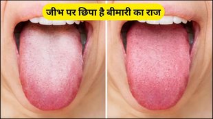 jeebh par lal pile nishan hone ke karan or bachav, jeebh par lal nishan hone ke karan, jeebh par pile nishan hone ke karan, Colour of tongue, find out about diseases by the colour of tongue