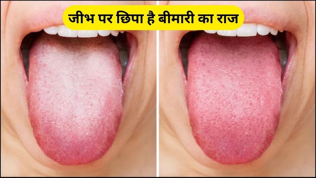 jeebh par lal pile nishan hone ke karan or bachav, jeebh par lal nishan hone ke karan, jeebh par pile nishan hone ke karan, Colour of tongue, find out about diseases by the colour of tongue