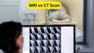 MRI और CT Scan के बीच का अंतर, X-Ray vs CT Scan vs MRI, Medical imaging techniques, CT scan conditions, MRI scan uses, X-Ray imaging explained