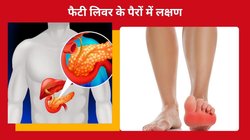 पैरों और पंजों में दिखते हैं लिवर की बीमारी के 6 संकेत, जब भी दिखे ये निशान तो समझिए खतरे में आ गया है जिगर, तुरंत करें लक्षणों की पहचान