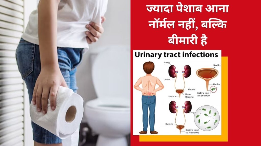 पेशाब बार-बार आना, टॉयलेट के बाद पेशाब लगना, बार-बार पेशाब आने के कारण, Pee ke baad bhi urine aana, Bar-bar peshab aane ke karan, Frequent urination reasons,