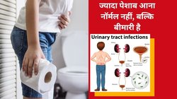 क्या हर 1 घंटे में आता है पेशाब? ज्यादा पानी पीने की वजह से नहीं बल्कि इन 5 बीमारियां में आता है ज्यादा यूरिन, यूरोलॉजिस्ट से जानिए असली वजह