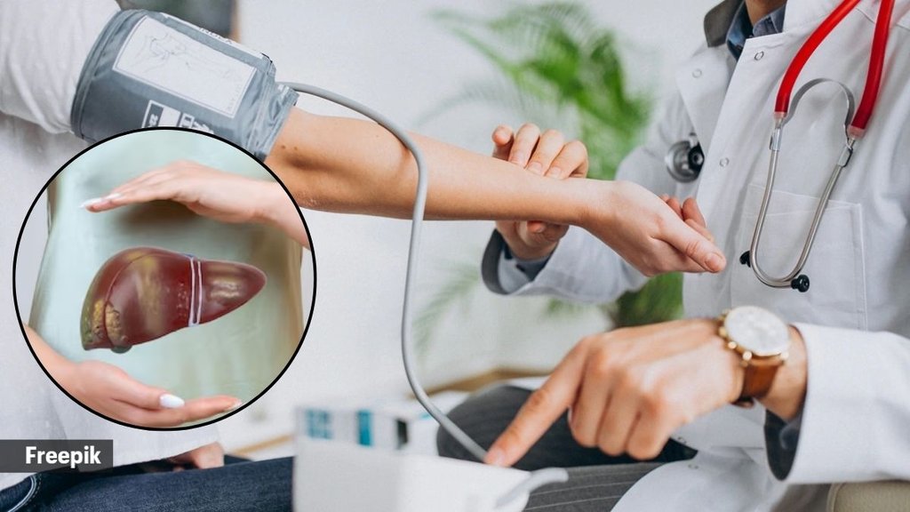 high blood pressure, Fatty Liver, Liver, how to cure bp and Fatty Liver