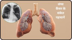 लंग्स कैंसर की शुरुआत में बॉडी में दिखते हैं ये 5 लक्षण, इग्नोर नहीं करें बल्कि तुरंत करें पहचान, समय रहते बच सकती है जान