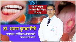 खराब ओरल हाइजीन की आदत कैंसर का बड़ा कारण, मुंह में पनप सकता है कई तरह के कैंसर, सीनियर डॉक्टर ने बताया बचने का तरीका