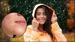 बारिश में स्किन से जुड़ी इन समस्याओं का बढ़ जाता है खतरा, नहीं रखा ध्यान तो चर्म रोग के हो जाएंगे शिकार