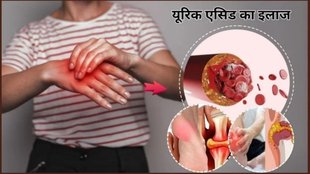 uric acid causes, symptoms and signs of increased uric acid, remedies to reduce uric acid, what to eat when uric acid increases