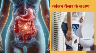 Common symptoms in younger population​,Colorectal cancer risk factor,​Increase in colorectal cancer cases​,Colon cancer warning signs and risk factors,colorectal cancer symptoms