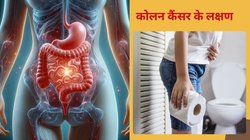 Colon Cancer Warning Signs: बड़ी आंत में कैंसर के 7 खतरनाक संकेत, वक्त रहते करें पहचान, वरना बढ़ सकता है जान का खतरा!