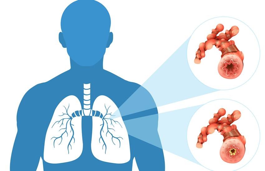 lung detox remedies