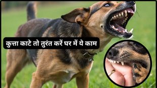 Dog bite first aid in Hindi, कुत्ते के काटने पर प्राथमिक उपचार, What to do after dog bite, Dog bite treatment at home, कुत्ता काटे तो क्या करें,Dog bite rabies vaccine time, कुत्ते के काटने पर कौन सी वैक्सीन लगती है,