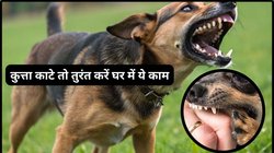 कुत्ते के काटने के तुरंत बाद First Aid कैसे करें? अभी से जान लीजिए Rabies से बचाव के लिए तुरंत किए जाने वाले जरूरी कदम