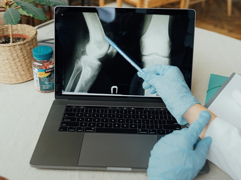 Do not Overlook These Subtle Signs of Bone Cancer