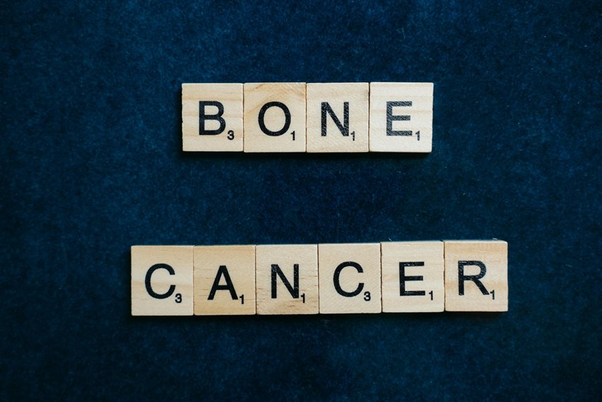 Early Signs of Bone Cancer You Should Never Ignore
