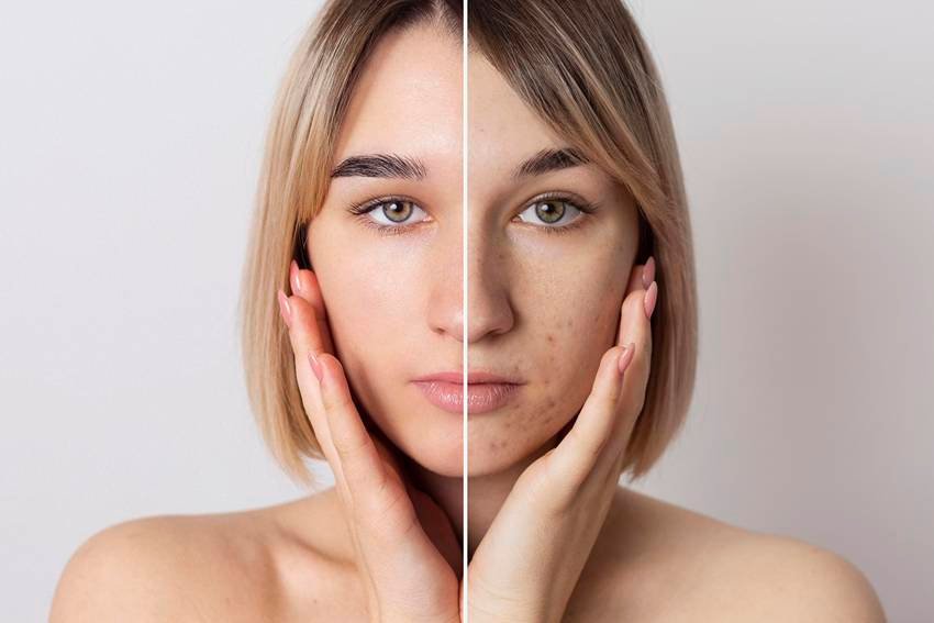 unhealthy foods for skin
