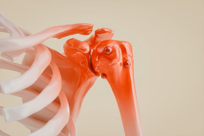 How Your Bones May Be Telling You About Cancer