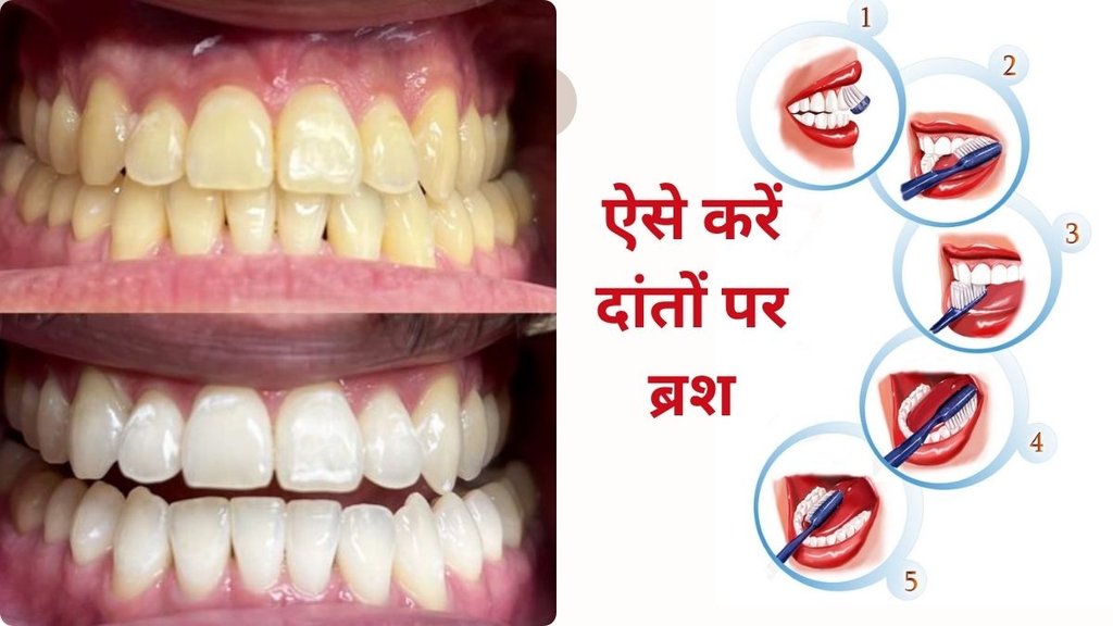 Brushing Your Teeth 2, 5, or 10 Minutes, How Long Should You Really Brush Your Teeth, 2 Minutes or More? Ideal Brushing Time Recommended by Experts