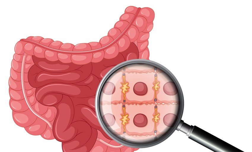 Intestinal cleansing home remedies