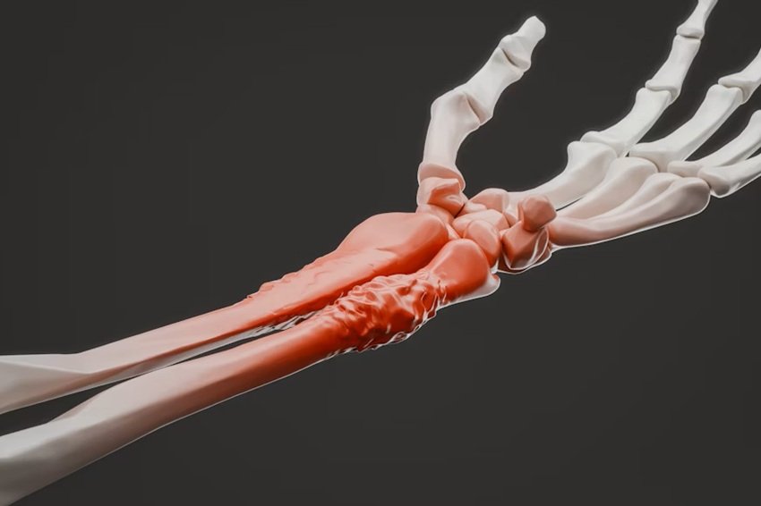 Silent Symptoms of Bone Cancer
