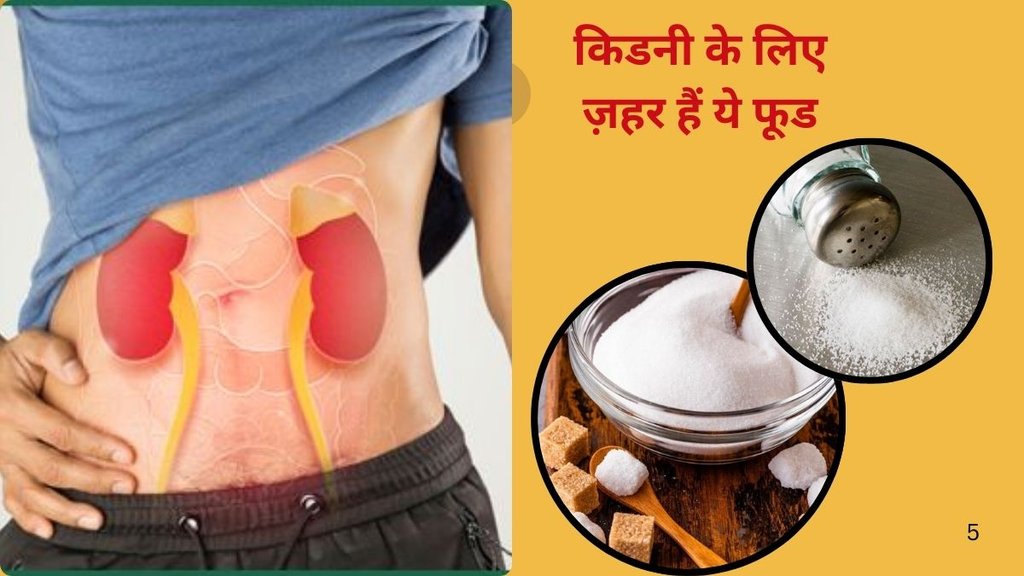 harmful white foods, white foods bad for kidneys, kidney health diet tips, foods to avoid for kidney health, kidney damage foods, unhealthy white foods, white foods to eliminate,