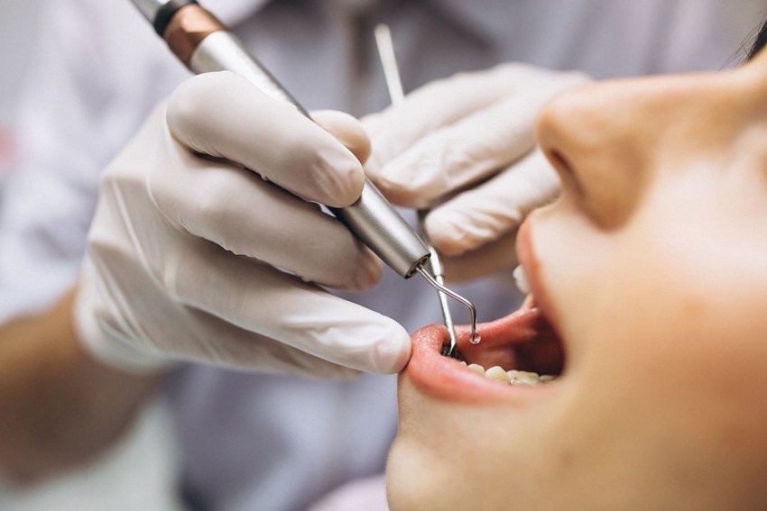 Home treatment for tooth nerve pain