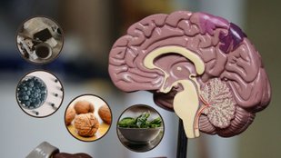 brain friendly nutrition