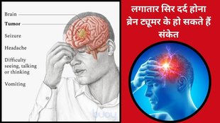 Memory Loss Symptoms,Headaches and brain tumors,early signs of brain tumors,brain tumor symptoms,Brain Tumor Symptoms,brain health warning signs,