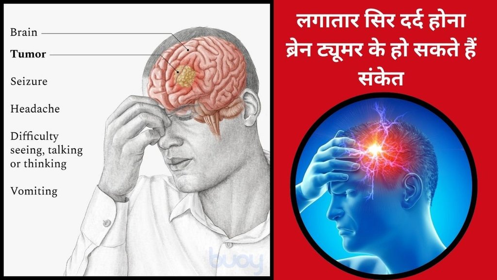 Memory Loss Symptoms,Headaches and brain tumors,early signs of brain tumors,brain tumor symptoms,Brain Tumor Symptoms,brain health warning signs,
