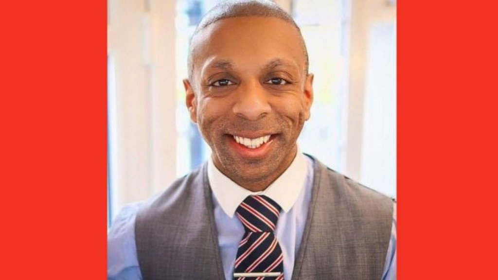 British man, HAIR TRANSPLANT