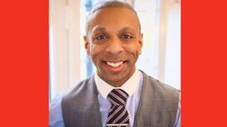 तुर्की में हेयर ट्रांसप्लांट कराने गया था ब्रिटिश नागरिक, अचानक बीमार पड़ने से मौत; जानिए क्लिनिक ने क्या कहा