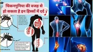 chikungunya fever, chikungunya causes, chikungunya symptoms, chikungunya treatment, chikungunya prevention tips, chikungunya diagnosis test, when to test for chikungunya, chikungunya RT-PCR vs ELISA test, how to detect chikungunya at home