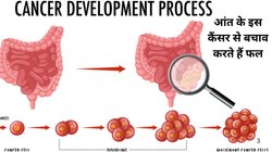 Colon Cancer: युवाओं में तेजी से पनप रहा है आंत का कैंसर, लेकिन डरने की जरुरत नहीं, इन 4 फलों से भागती रहेगी यह बीमारी