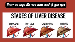 foods bad for liver, What damages liver health, Liver damaging foods, Foods that harm liver, Liver health tips, Fatty liver diet restrictions,