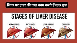 लिवर के लिए ज़हर हैं हेल्दी समझे जाने वाले ये सुपरफूड, Fatty Liver को बना देते हैं जानलेवा, हार्वर्ड के डॉक्टर ने बताया साइलेंट किलर