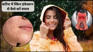 Mold and Fungus, Rainy season problems, monsoon skincare routine, rain season skin problems, skin protection in rainy season, fungal infection in monsoon, skincare tips for monsoon season