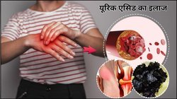 यूरिक एसिड का दुश्मन है काला गोंद, जोड़ों के दर्द और गठिया के भी मिलेगी राहत, आयुर्वेद एक्सपर्ट ने बताया कैसे करें इस्तेमाल
