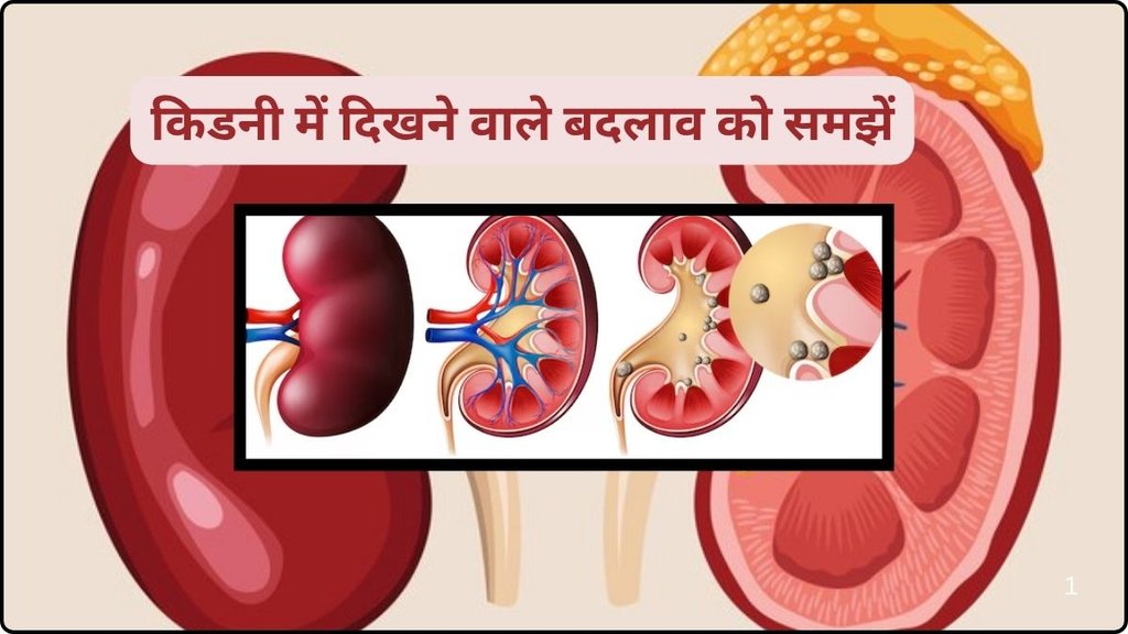 Kidney Cancer Symptoms,Kidney Cancer Signs,Kidney Cancer,Cancer Symptoms,Cancer,These symptoms seen when you have kidney cancer, kidney cancer