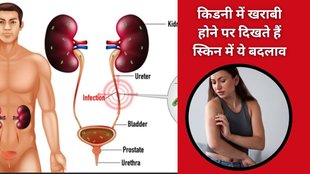 skincare for kidney disease,skin changes kidney disease,kidney health,kidney disease symptoms,kidney disease diagnosis,kidney disease and rashes