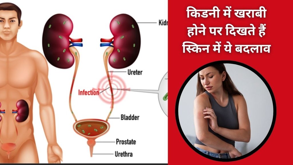 skincare for kidney disease,skin changes kidney disease,kidney health,kidney disease symptoms,kidney disease diagnosis,kidney disease and rashes