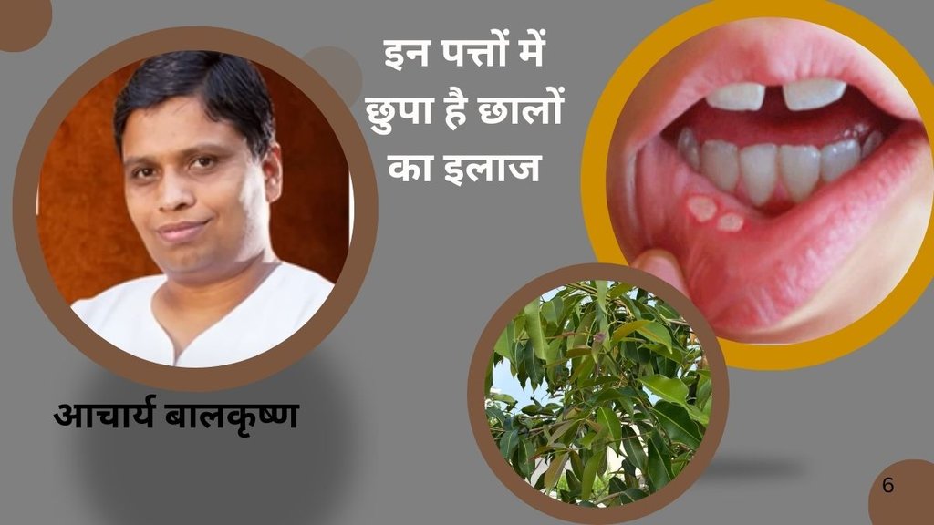 Mouth ulcer home remedy, Ayurvedic treatment for ulcers, Acharya Balkrishna health tips, Natural cure for mouth sores, Stomach cleansing ayurvedic remedy,