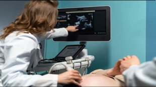 ultrasound, sonography, ultrasonography, ultrasound in pregnancy, sonography in pregnancy, sonography side effects on baby,