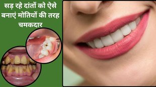 natural home remedies for white teeth, how to make white teeth, ayurvedic herbs for white teeth, salt turmeric and mustard oil tooth past for oral health,