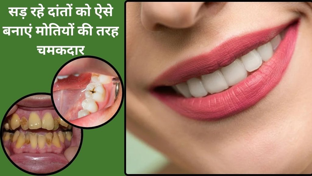 natural home remedies for white teeth, how to make white teeth, ayurvedic herbs for white teeth, salt turmeric and mustard oil tooth past for oral health,