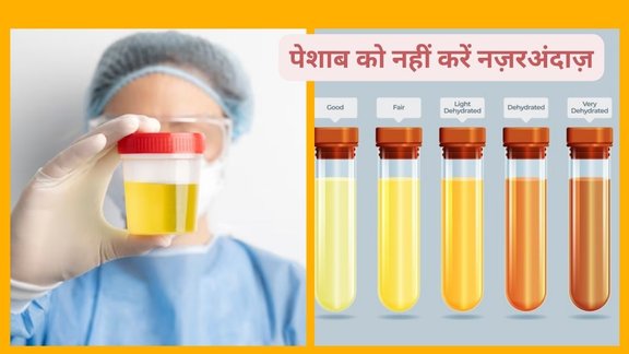 smelly urine, acidic urine, foul-smelling urine, urine odor causes, UTI symptoms, kidney problems, diabetes urine smell, dehydration urine