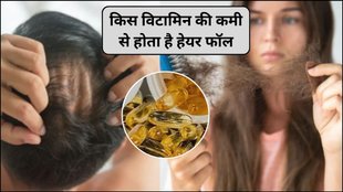 kis vitamin ki kami se baal jhadte hain, baal jhadna, baal kyu jhadte hai, baal jhadne ke karan, baal jhadte hai to kya kare, baal jhadne se kaise bache, Hair Loss, Vitamin D, Vitamin D Deficiency, vitamin d deficiency and hair fall