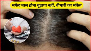 White Hair Problem, Hair Problem, grey hair, thyroid health, stress and grey hair, preventing grey hair, premature greying, nutrition and hair health