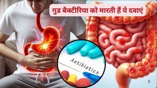 fermented foods,prebiotic foods,gut health,